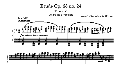 Etude Op. 63 no. 24 (Uncrossed)